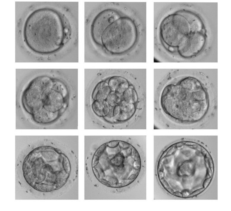 grid of nine microscopy images