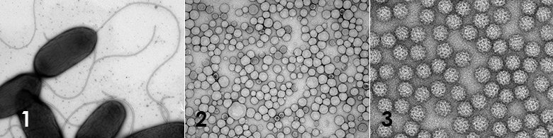 Photo of electron microscopy