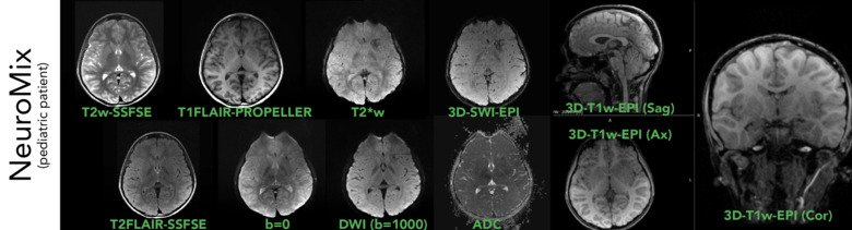 neuromix