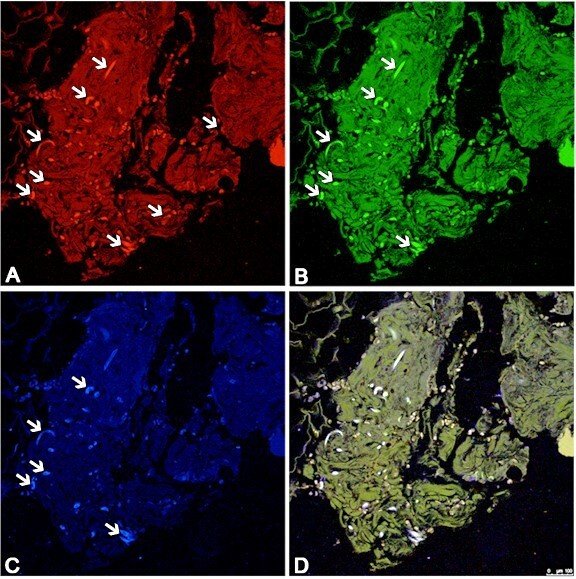 Example of high-power photomicrographs in four different colors: A,B, C and D