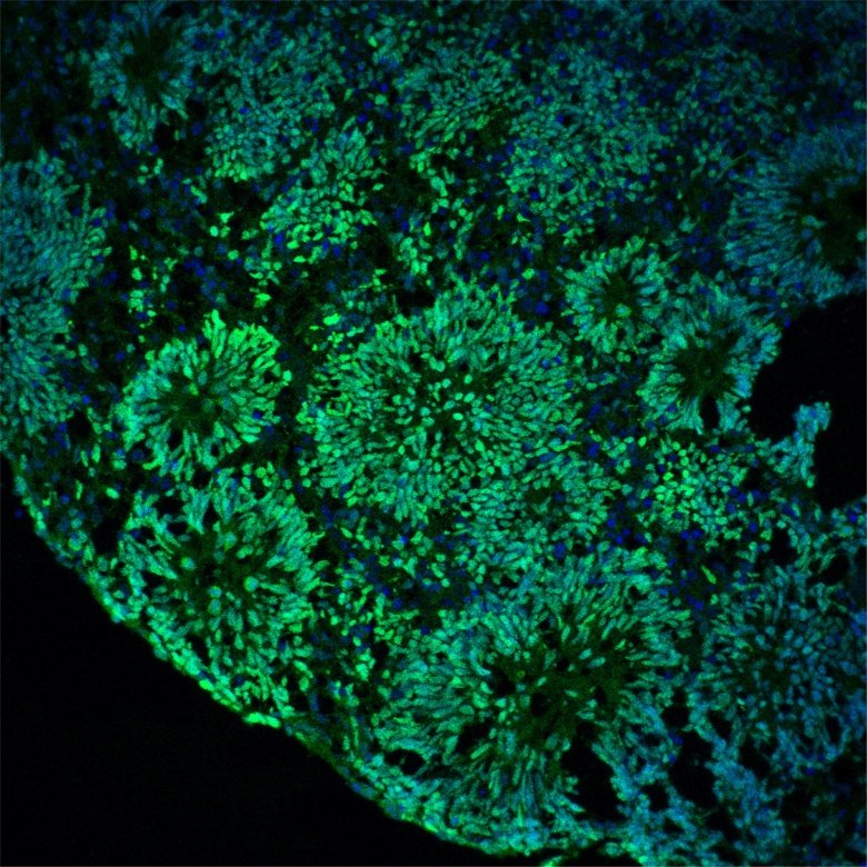 Image Description: Cerebral organoids displaying three-dimensional ventricle organization.