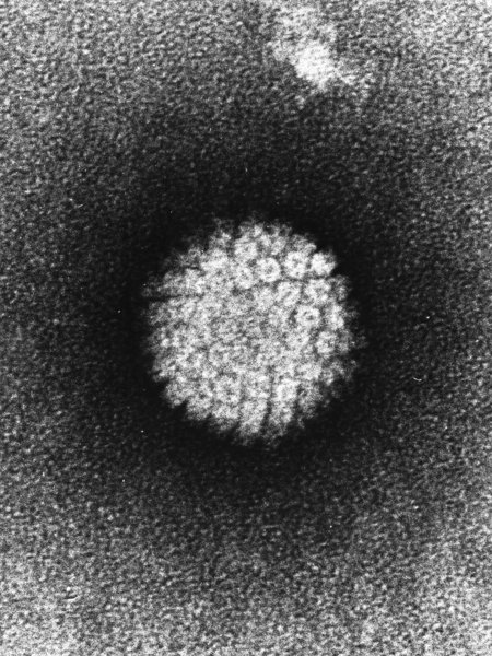 Image of a human papilloma virus.