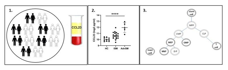 Systemic mastocytosis (SM) and prognostic markers of disease_Johanna Ungerstedt