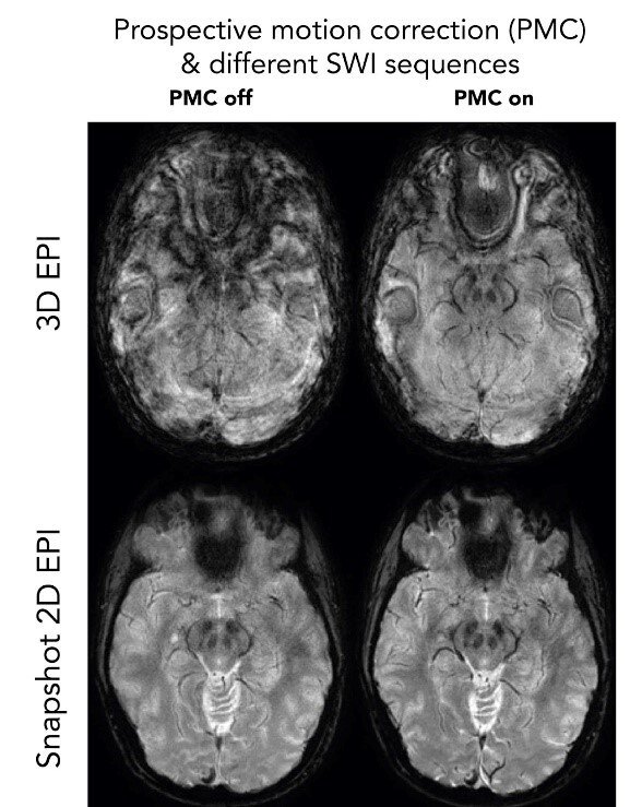 prospective motion correction