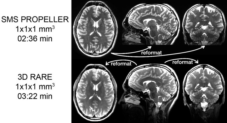 neuromix