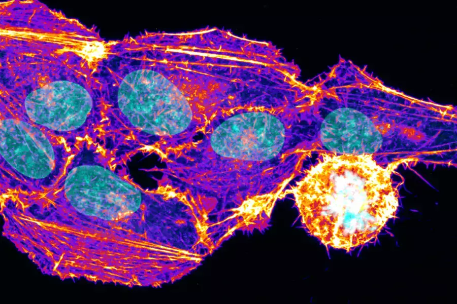 Imaging live cells, image from Biomedicum Imaging Core (BIC). Credit: Florian Salomons.