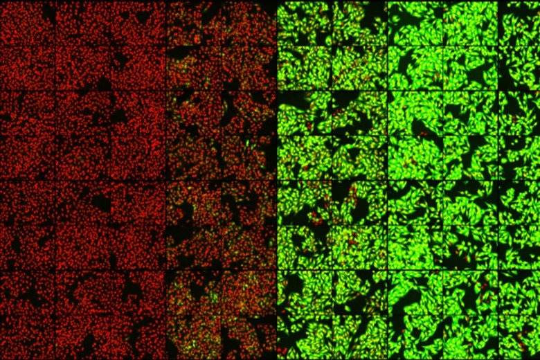 Image from Biomedicum Imaging Core. Credit: Florian Salomons.
