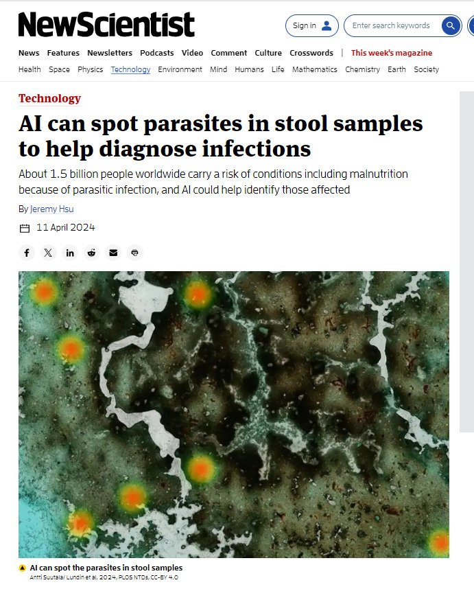 AI can spot parasites in stool samples to help diagnose infections