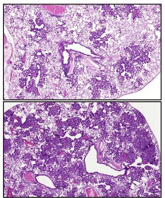 microscopy images of lungs in purple and white