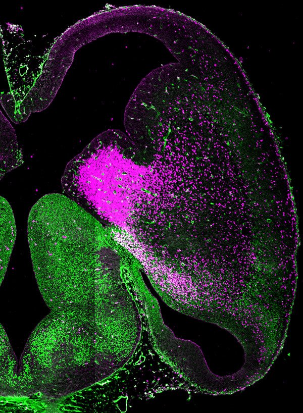 Image from Biomedicum Imaging Core. Credit: Shigeaki Kanatani.