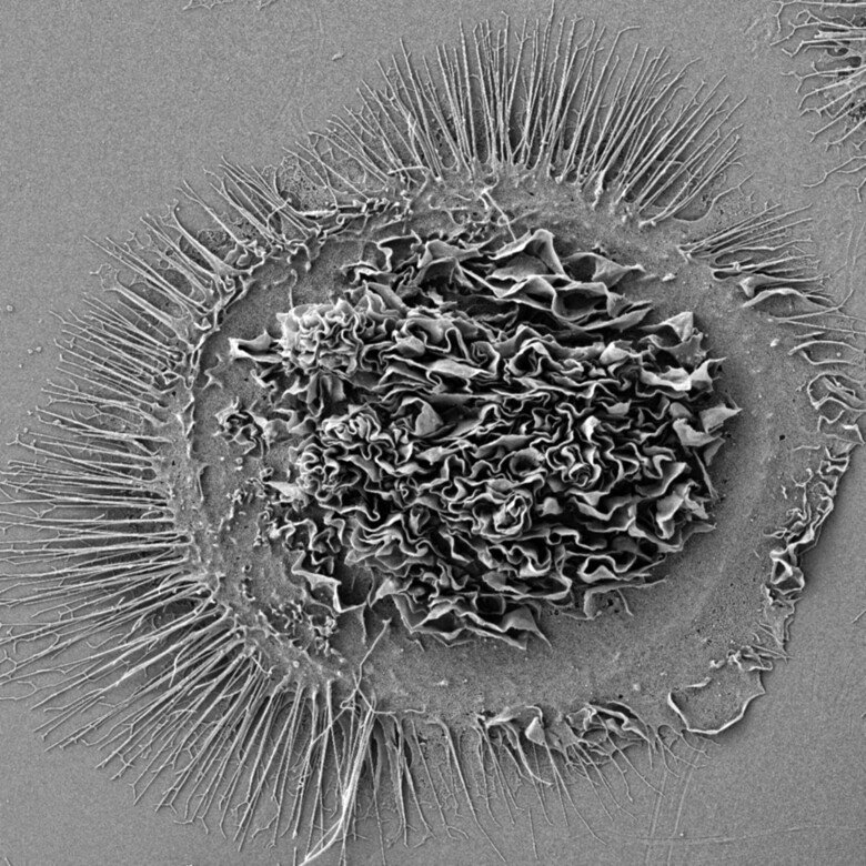 Genre image of of a Alveolar macrophage from a SEM microscope at the EMiL corefacility , BCM.