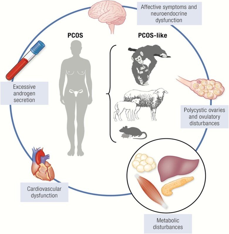 An illustration of PCOS from Stener-Victorin et al. Endocr Rev, 2020,41:4; 538–576