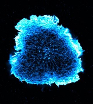 A microscope picture of a T cell with F-actin