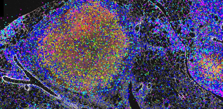 TB infection in mouse lung. Credit: Berit Carrow