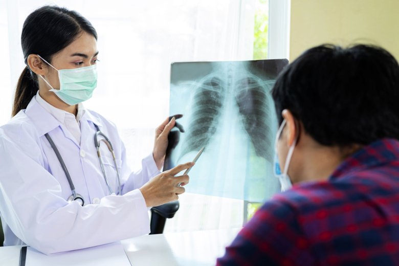 A doctor is showing scans of lungs