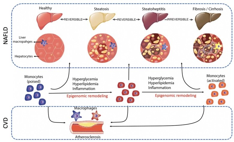 illustration of a healthy liver going to Fibrosis/cirrhosis