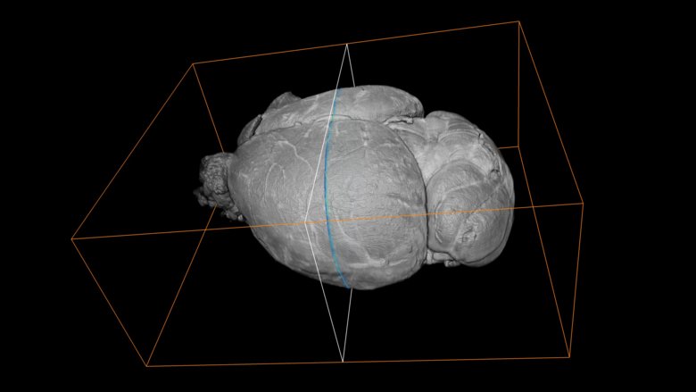 Mouse brain