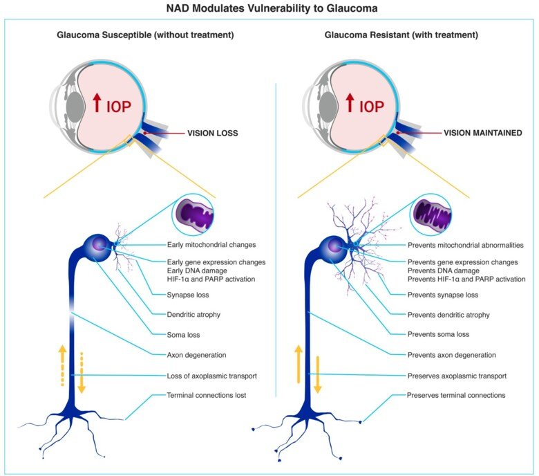 NAD Glaucoma