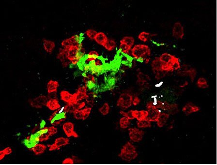 High-resolution confocal microscopy