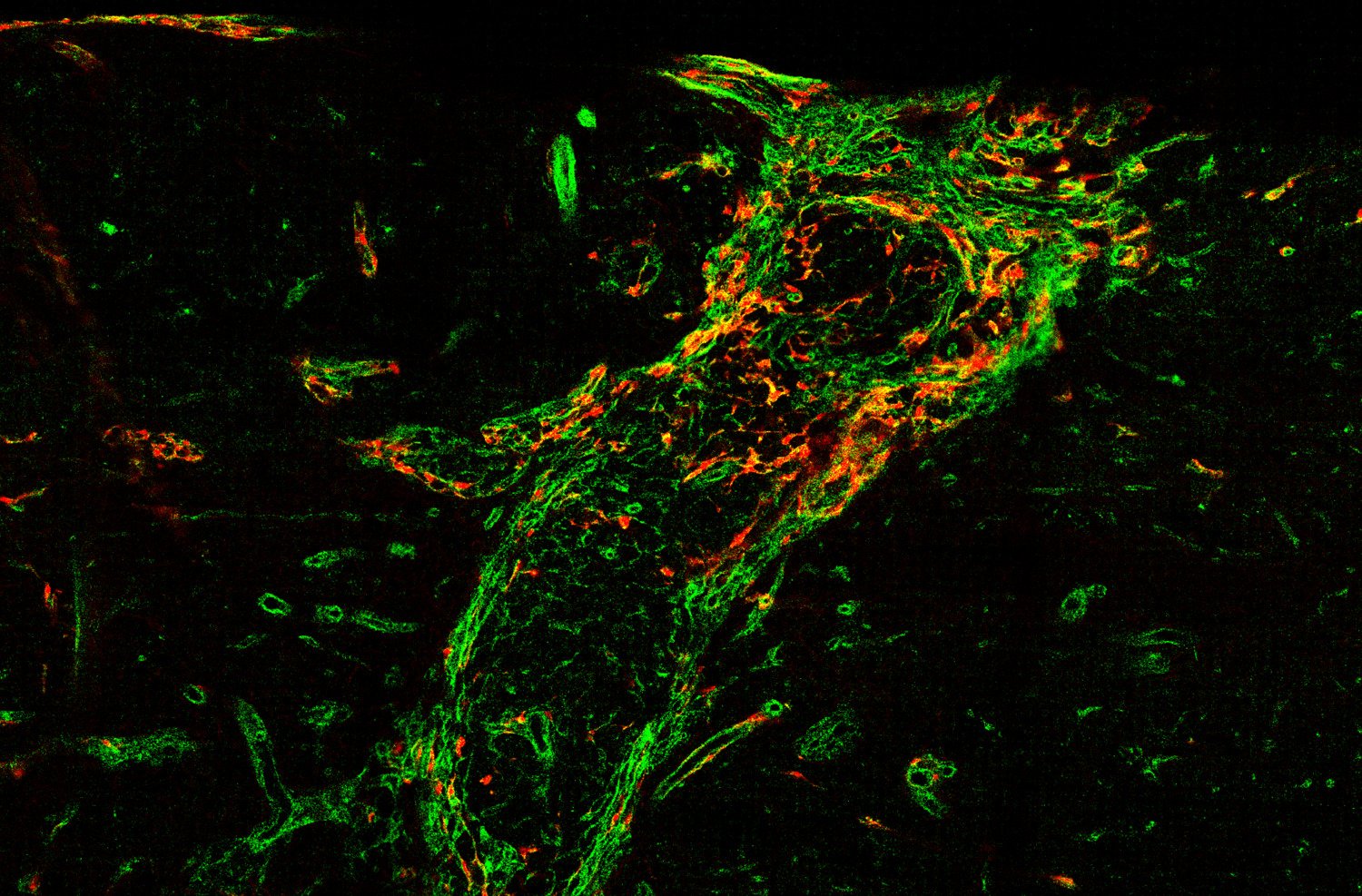 Microscopy image of fibrotic scar tissue after spinal cord injury