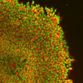 A human patient iPS cell colony stained for pluripotency markers Oct4 in green and Tra1-81 in red