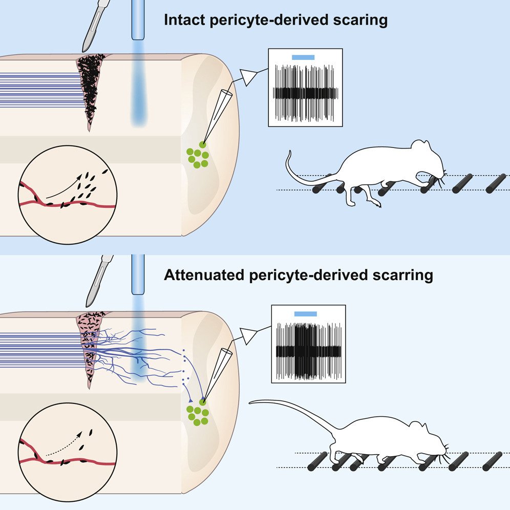 Reducing Pericyte-Derived Scarring Promotes Recovery after Spinal Cord Injury