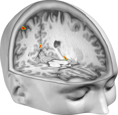Brain regions in which the scientists could successfully decode the participants’ perceived self-location from patterns of neural activity.
