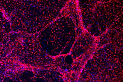 Cortical stem cells