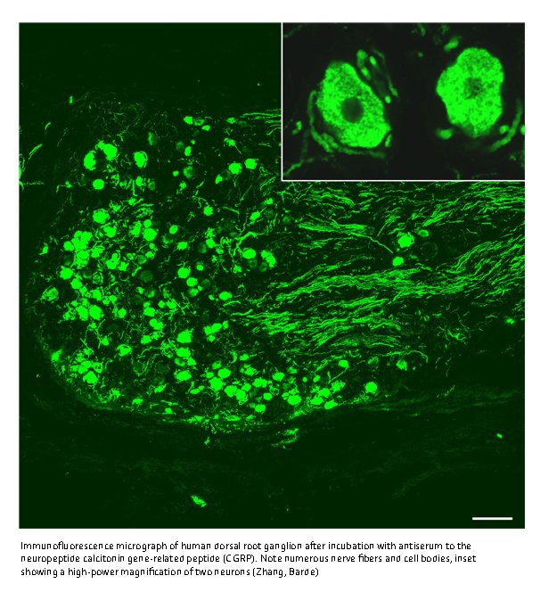 Immunofluorescence micrograph of human dorsal root ganglion after incubation with antiserum to the neuropeptide calcitonin gene-related peptide (CGRP).