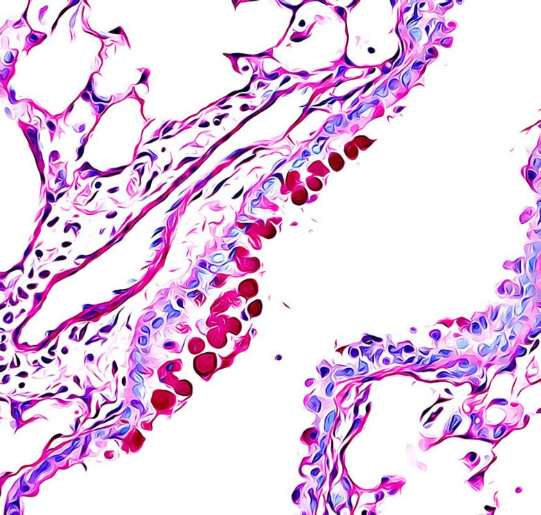 Microscope image of inflammated airways.