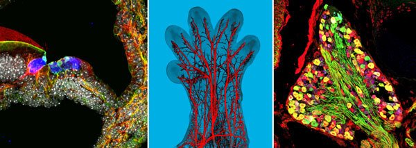 From left to right, Sensory epithelium of a P3 mouse cochlea, Innervation of a E14.5 mouse forelimb and Genetic tracing in a perinatal mouse dorsal root ganglion.