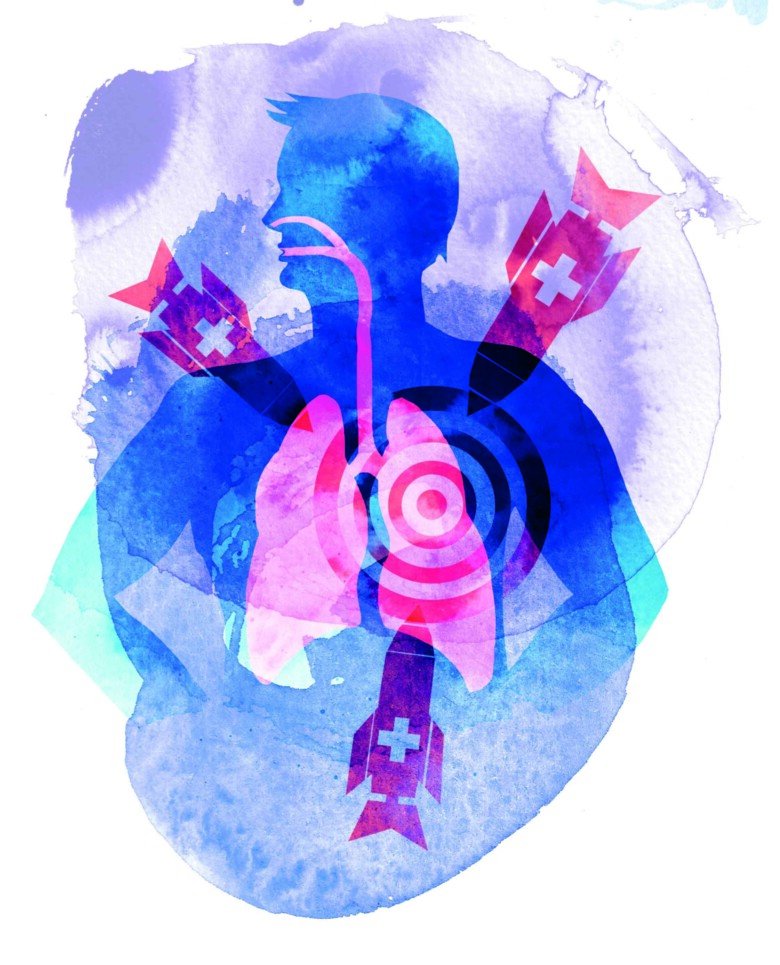 Lungcancer illustrationer