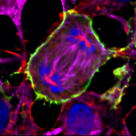 Mitotic HEK293 cells transfected with v3-GFP.