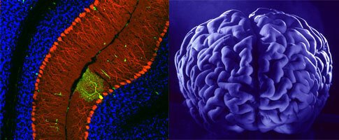 montage of two images illustrating Neuroscience at KI. To the right image of brain by Lennart Nilsson.