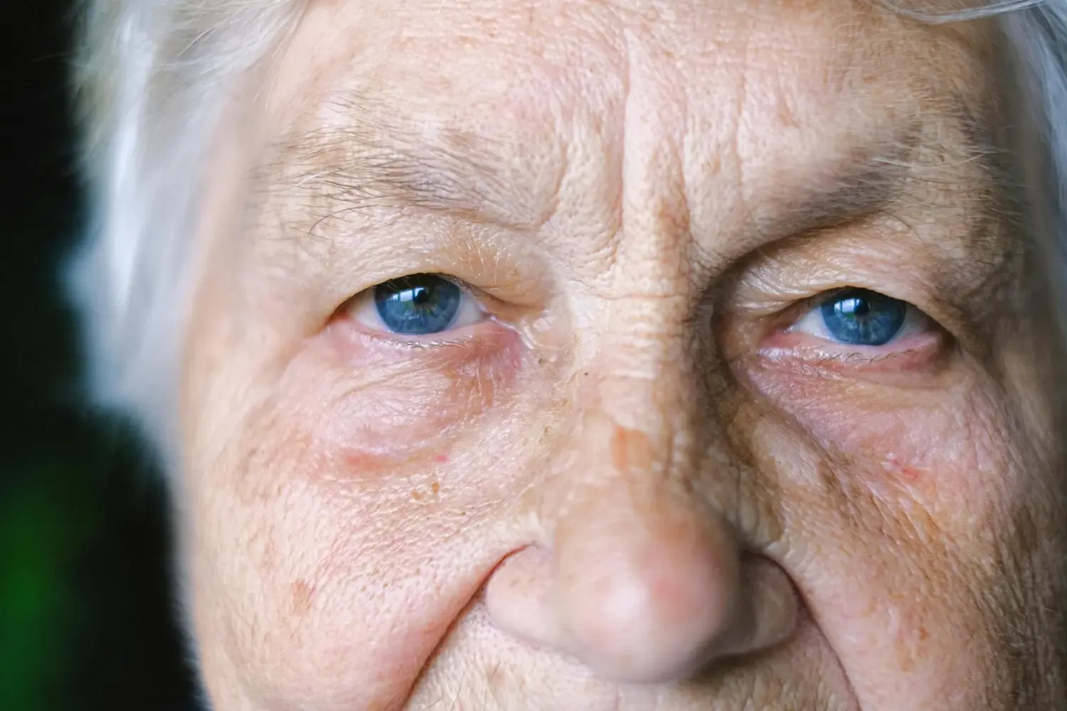 Close-up of an older person’s face with focus on the eyes.