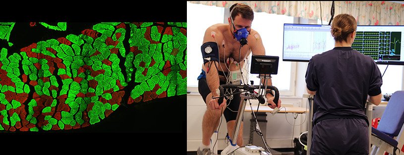 235 / 5,000 Two side-by-side photographs, one of which shows a section of muscle stained with immunohistochemistry, showing which muscles are fast and slow. The second image shows a test subject doing a work test on a test cycle.