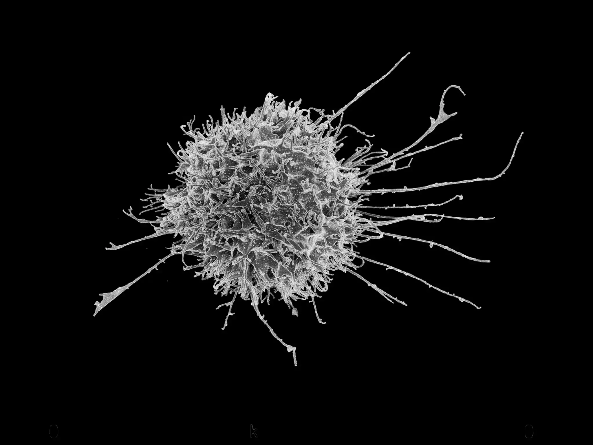 NK cell. Photo: NIAID, cc-by