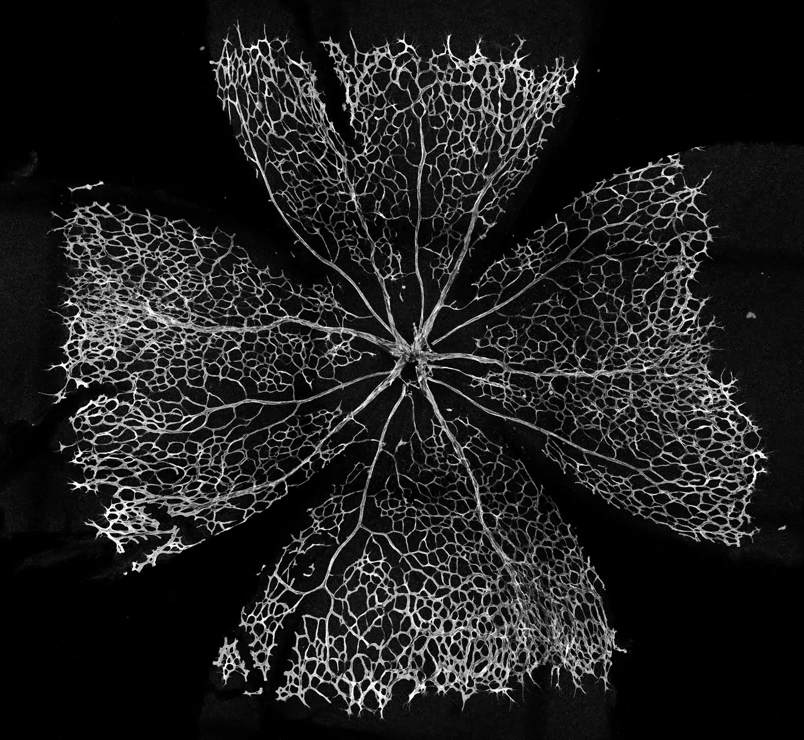 Fluorescence microscopy.