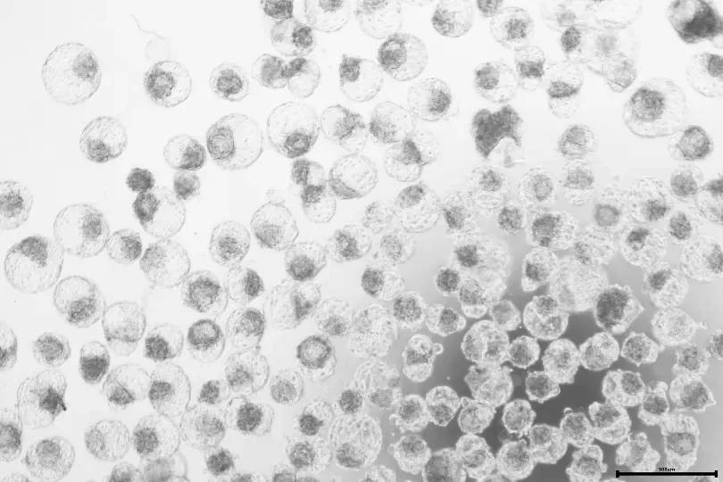Picture of blastoids