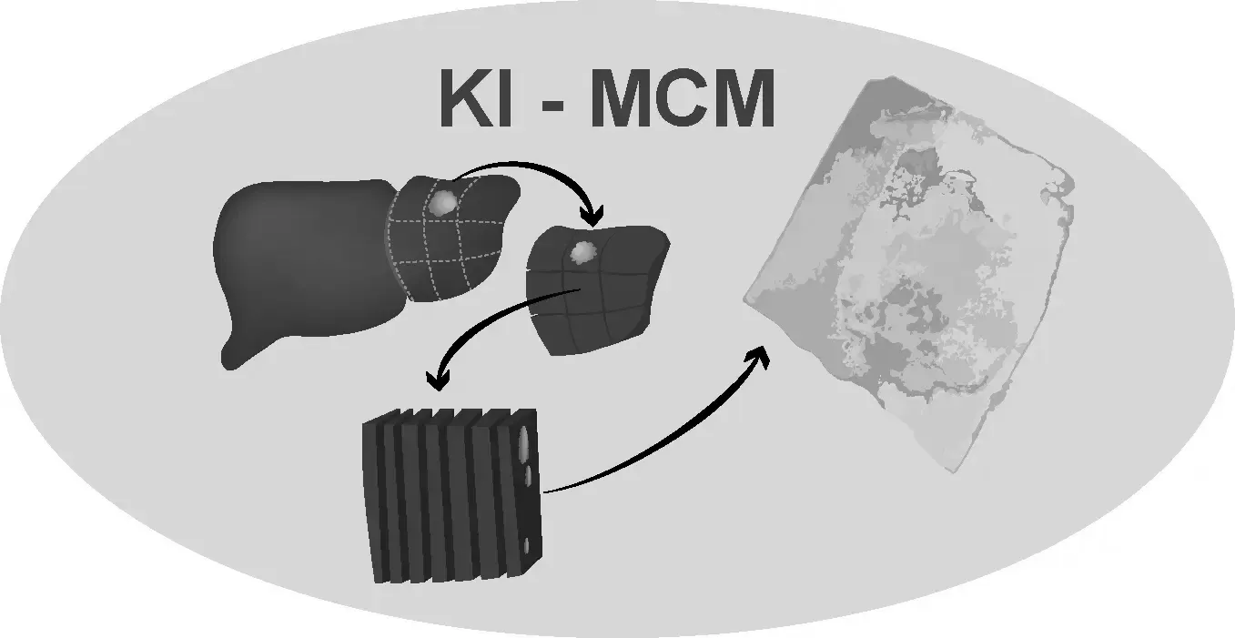 KI-MCM Network
