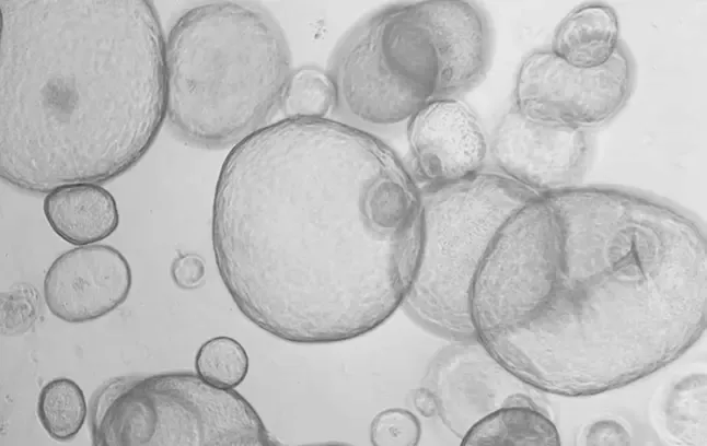 Endometrial epithelial organoids derived from healthy fertile donors.