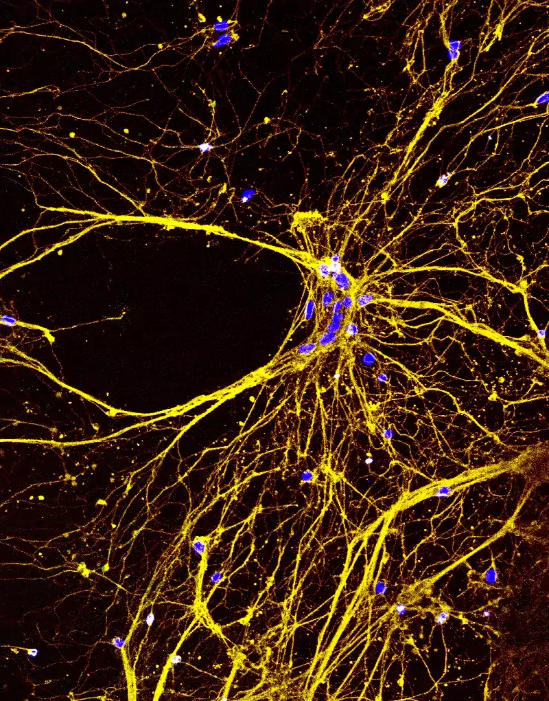 Photograph of neurons