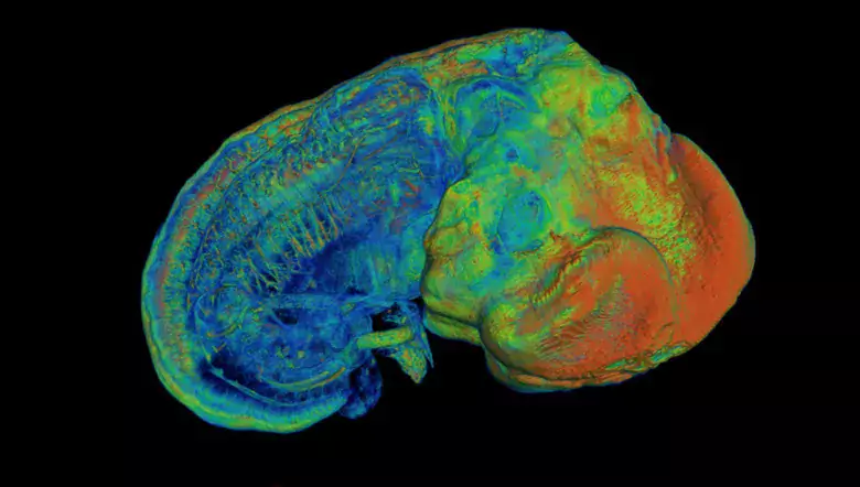 Image from Biomedicum Imaging Core. Credit: Shigeaki Kanatani.