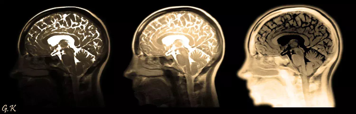 Decorative image showing three profiles with visible brains.