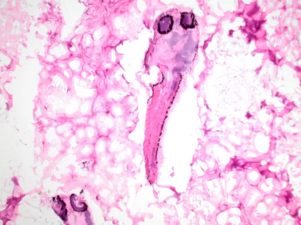 Zebrafish embedded in biomaterial, hematoxylin staining, 20x