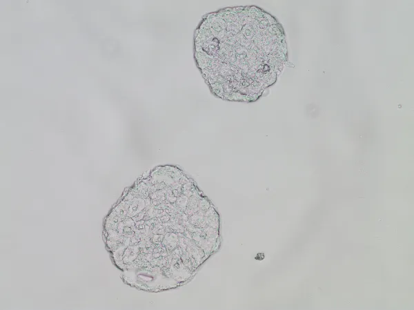 Cryosections of spheroids, 20x magnification.