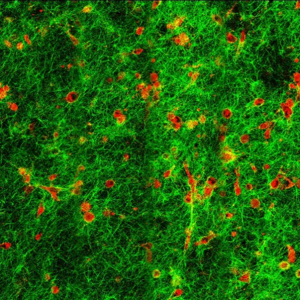 Cells in collagen