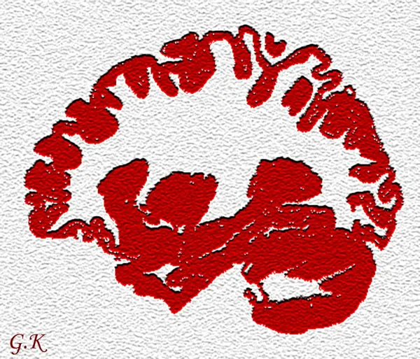 Art: decorative images created using MRI