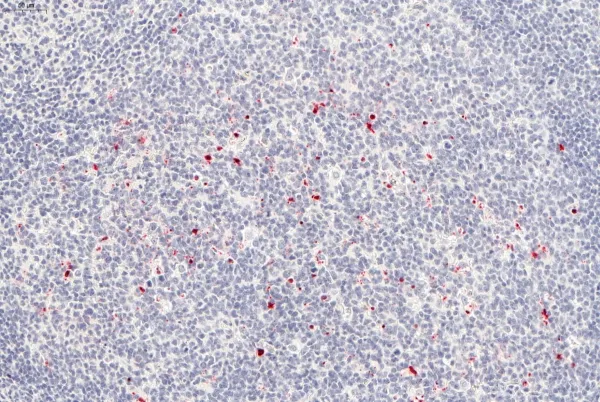Image of Caspase-3 IHC Fast Red chromogen tonsill