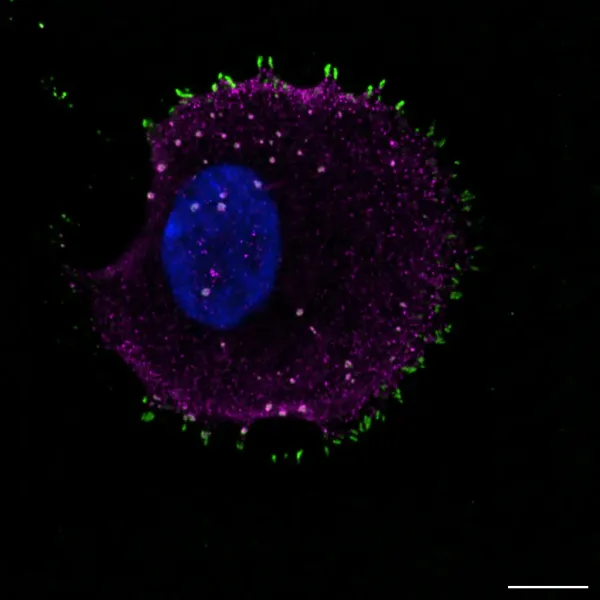 Reticular focal adhesions